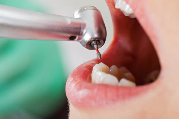 Best Emergency Denture Repair in Orion, IL